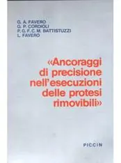 Direct Beschikbaar Ancoraggi di precisione nelle esecuzioni delle protesi rimovibili