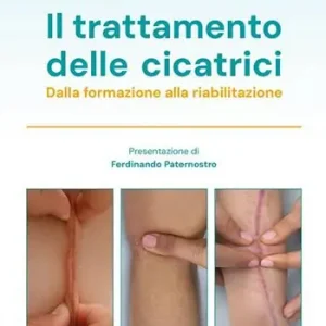 Il trattamento delle cicatrici. Dalla formazione alla riabilitazione Hoge Kwaliteit
